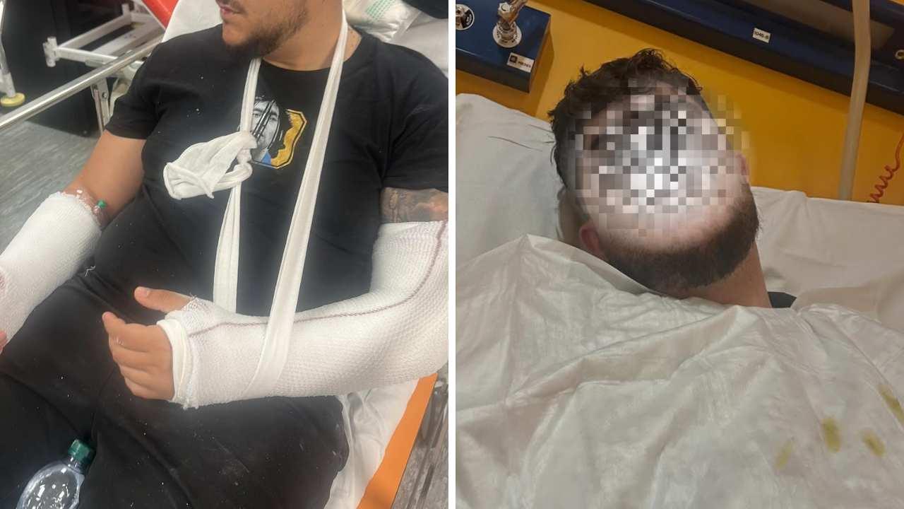 Tifoso del Napoli ferito a Parma